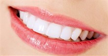 Cách làm trắng răng bị vàng tại nhà nhanh và hiệu quả nhất