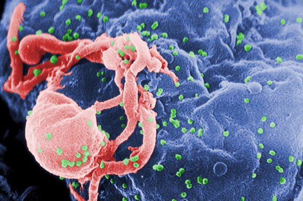 Những virus-1 (HIV-1) được nhìn qua một kính hiển vi điện tử