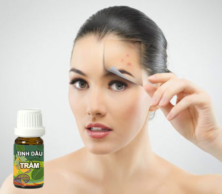 Sử dụng tinh dầu tràm để trị mụn