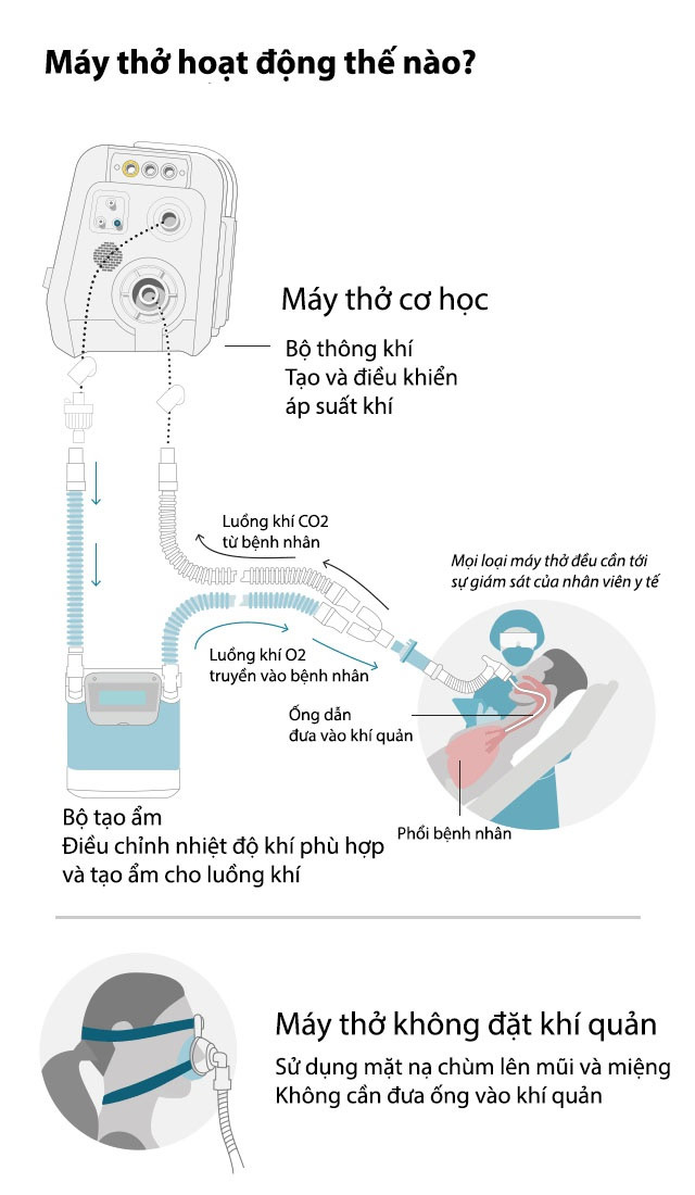 Cách hoạt động của máy thở. Nguồn: BBC/Hamilton Medical.