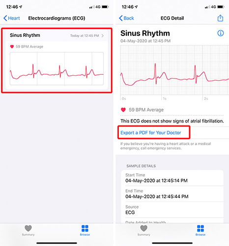 Nhấn vào Export a PDF for Your Doctor