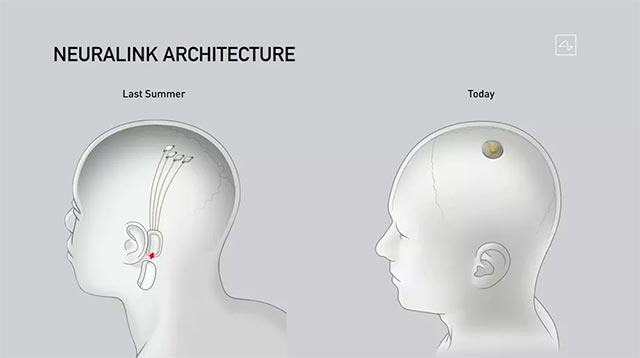 Công Ty Elon Musk Thử Nghiệm Cấy Ghép Hệ Thống Neuralink Trên Não Của Lợn