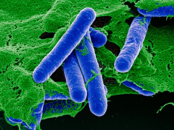 Vi khuẩn hình que Clostridium botulinum. Ảnh: Nature.