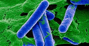 Vi khuẩn clostridium botulinum là gì? Nguy hiểm như thế nào?