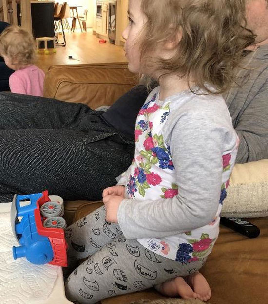 Chân em bé này có cái gì đó sai sai đùng không