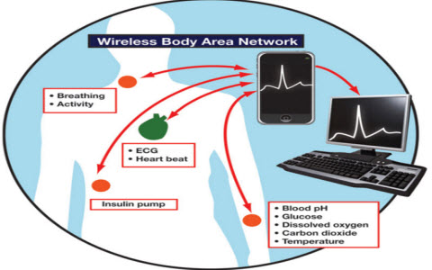 WBAN là một mạng lưới chứa các nút cảm biến được gắn vào cơ thể con người
