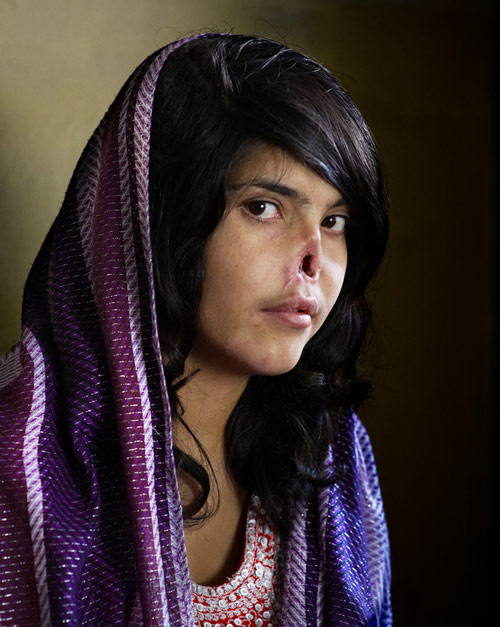 Bức ảnh chụp Aesha Mohammadzai, một người phụ nữ Afghanistan - đã xuất hiện trên trang bìa tạp chí Time vào tháng 8 năm 2010. Cô bị chồng và con rể người Taliban trừng phạt bằng cách chặt mũi và tai rồi bỏ mặc cô cho đến chết vì tội bỏ trốn. Aesha trở thành biểu tượng cho sự áp bức phụ nữ ở Afghanistan. Cô đã phải trải qua nhiều cuộc phẫu thuật để tái tạo mũi.