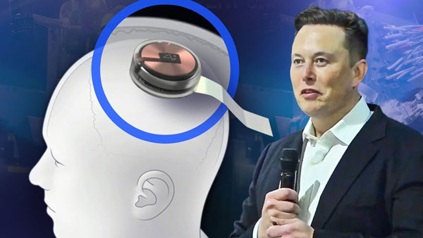 Neuralink của Elon Musk đang chuẩn bị việc cấy chip lên não người sẽ được tiến hành vào cuối năm nay. Ảnh: Cnet.