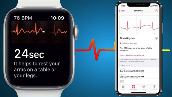 Apple Watch hiện tại mới chỉ có cảm biến đo nhịp tim ECG
