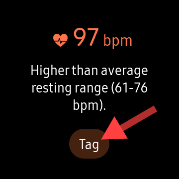 Nhấn vào “Tag” để thêm ghi chú