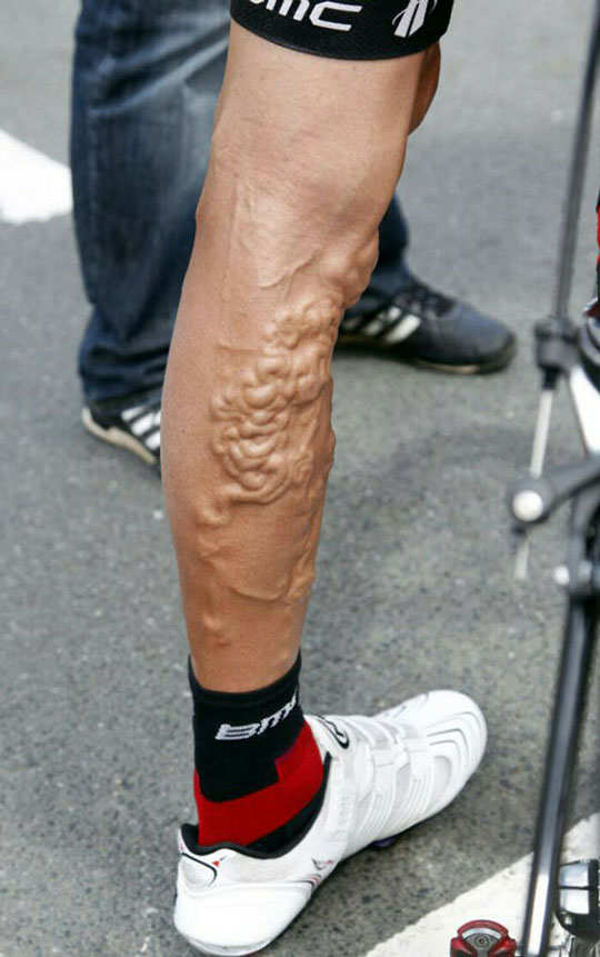 Còn đây là cơ nổi trên chân của vận động viên George Hincapie sau cuộc đua xe đạp Tour De France.