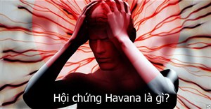 Hội chứng Havana là gì?