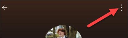  Tùy chọn tài khoản Spotify