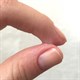 5 cách gỡ keo con voi dính vào da