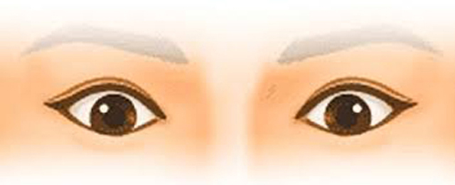 Mắt thượng tam bạch