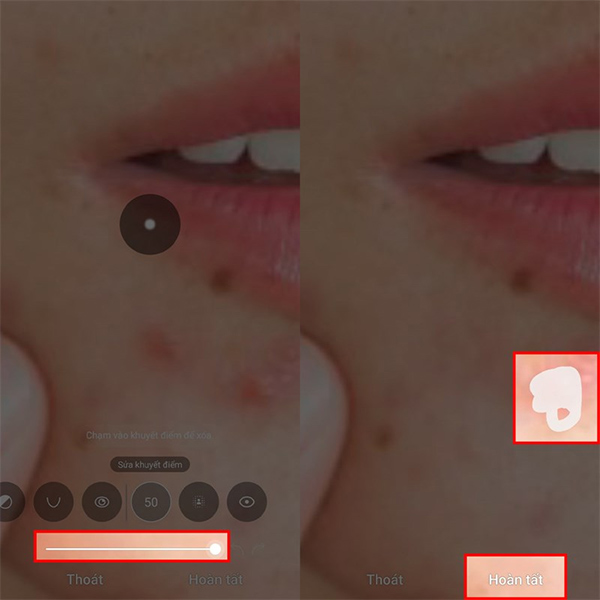 Che mụn trong ảnh trên điện thoại Samsung