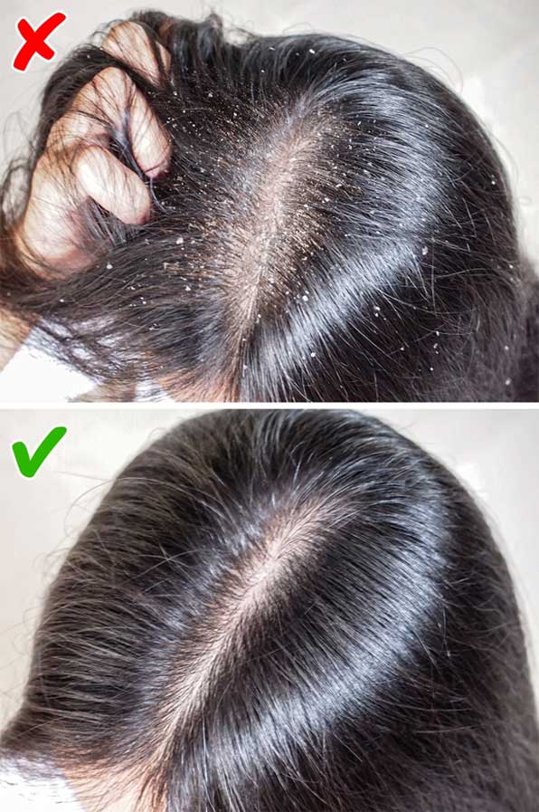 Gây hại cho tóc