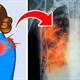 Dấu hiệu cảnh báo bệnh phổi bạn cần biết