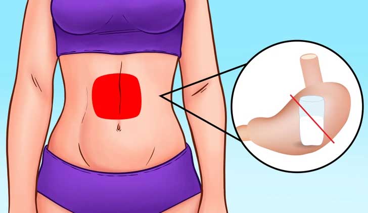 Không dung nạp lactose