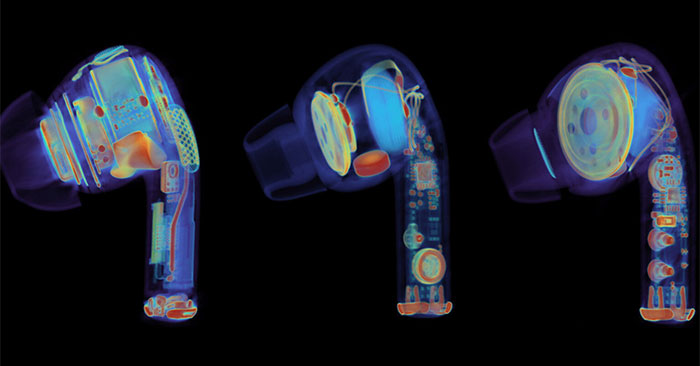 Ảnh chụp CT tai nghe