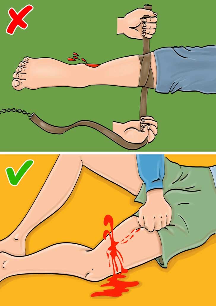 Cầm máu đúng cách