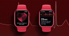Cách kích hoạt và sử dụng tính năng ECG trên Apple Watch