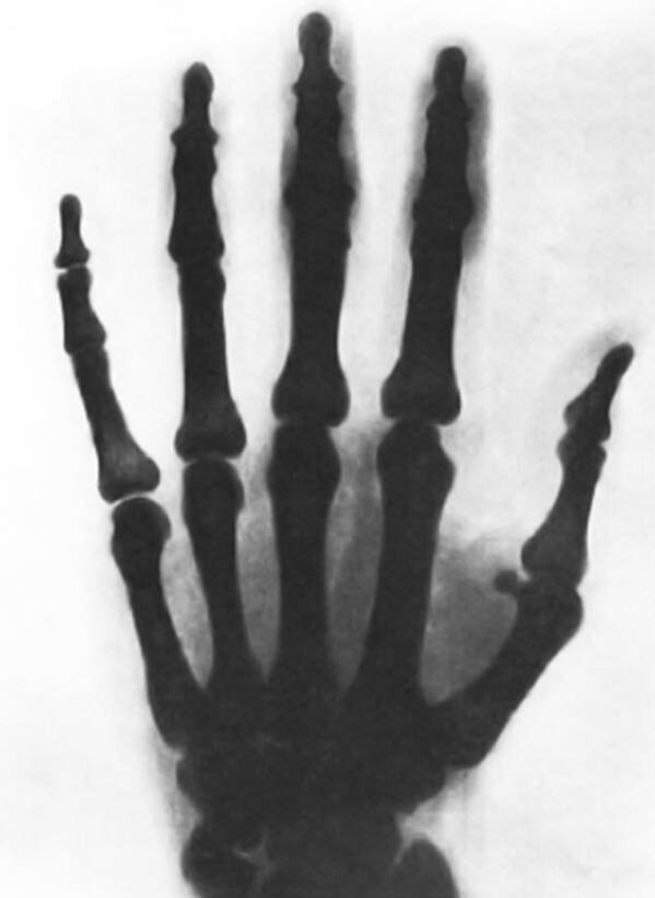 Ảnh chụp X-quang