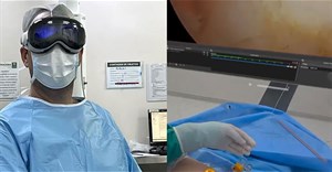 Apple Vision Pro được sử dụng trong ca phẫu thuật nội soi khớp vai ở Brazil