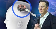 Chip não của Neuralink có thể bị hack không?