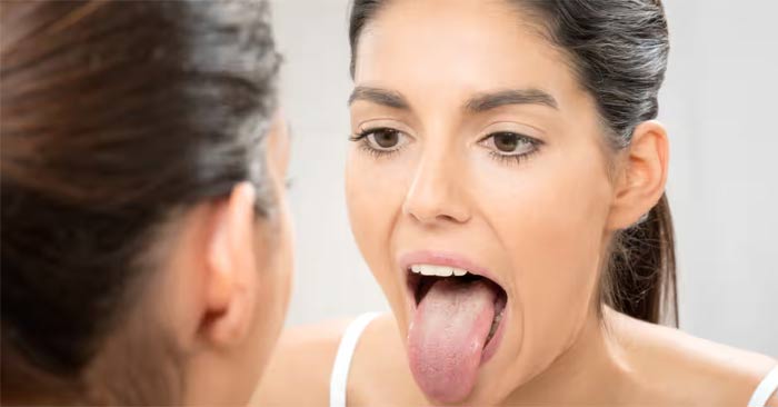 Ý nghĩa màu sắc của lưỡi