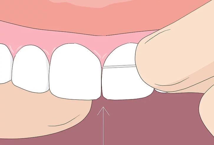 Vệ sinh răng miệng sạch sẽ bằng chỉ nha khoa