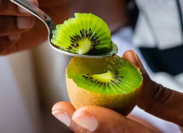 Quả Kiwi