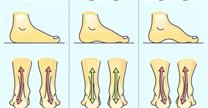 Những sai lầm thường gặp khi mua giày gây hại cho bàn chân