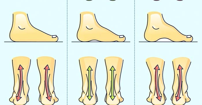 Không xác định kiểu chân