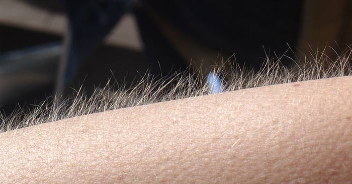 Phản ứng trên da