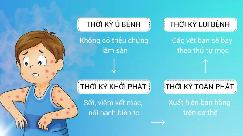 Quá trình diễn ra bệnh sởi