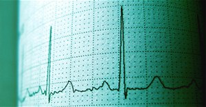 Phát triển thành công kỹ thuật MRI đo độ "già" của tim so với tuổi thật