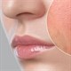 Sự khác biệt giữa da khô và da mất nước