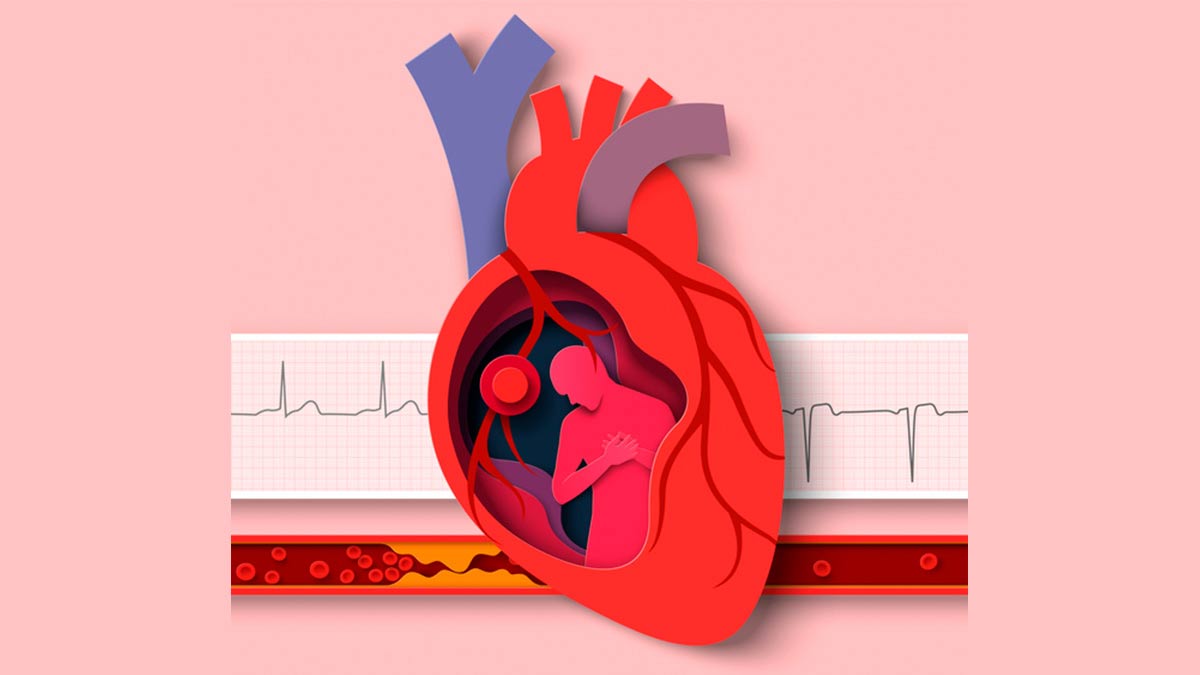 Kiểm soát cholesterol vì một trái tim khỏe mạnh