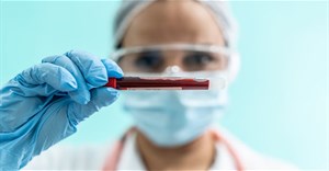 Máu người được tạo thành công trong phòng thí nghiệm mở ra kỷ nguyên mới cho y học tái tạo