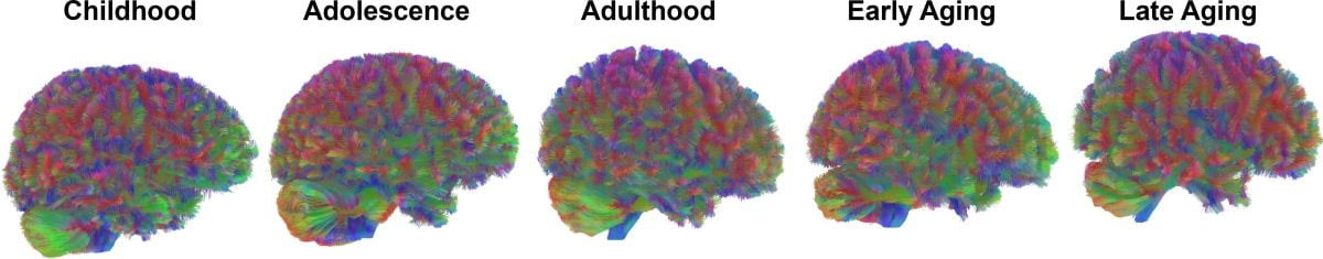 Hình ảnh MRI mô phỏng sự thay đổi của não bộ qua các giai đoạn trong đời người