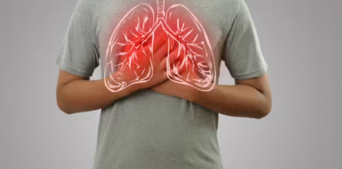 Bảo vệ phổi trước ô nhiễm không khí