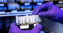 Thay đổi các chi tiết của bộ công cụ test