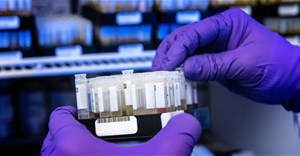 Thay đổi các chi tiết của bộ công cụ test